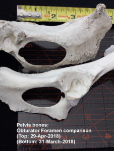 pelvic bones