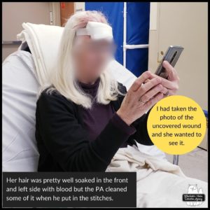 The Cook in the Emergency Room with head bandaged looking at her phone to see a photo of the injury; her hair was blood-soaked in front and on the left side.